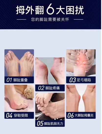 大拇指外翻矯正器