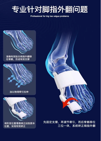 大拇指外翻矯正器