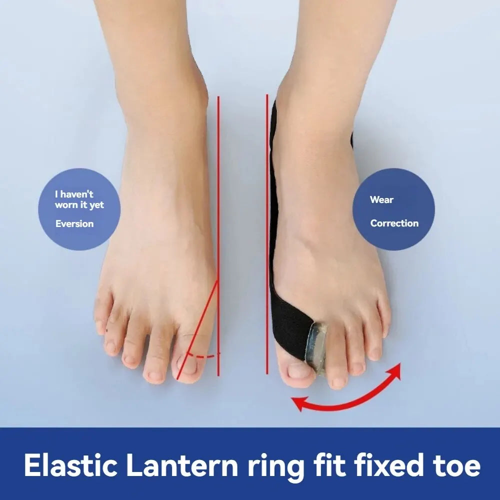 拇指外翻腳趾矯正器 (日夜用及可穿鞋)