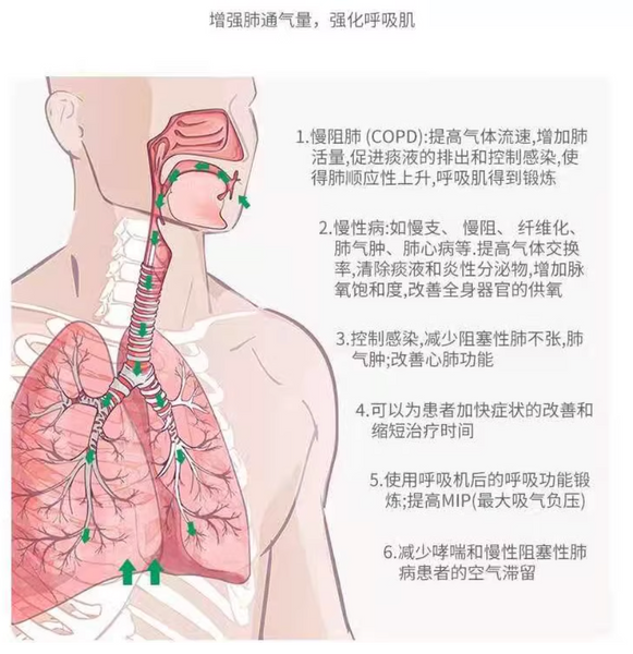 三球呼吸訓練器（可吹可吸型）
